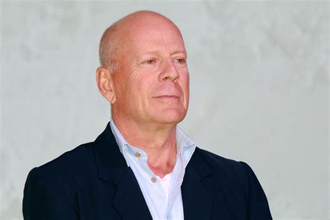 bruce willis has what type of aphasia